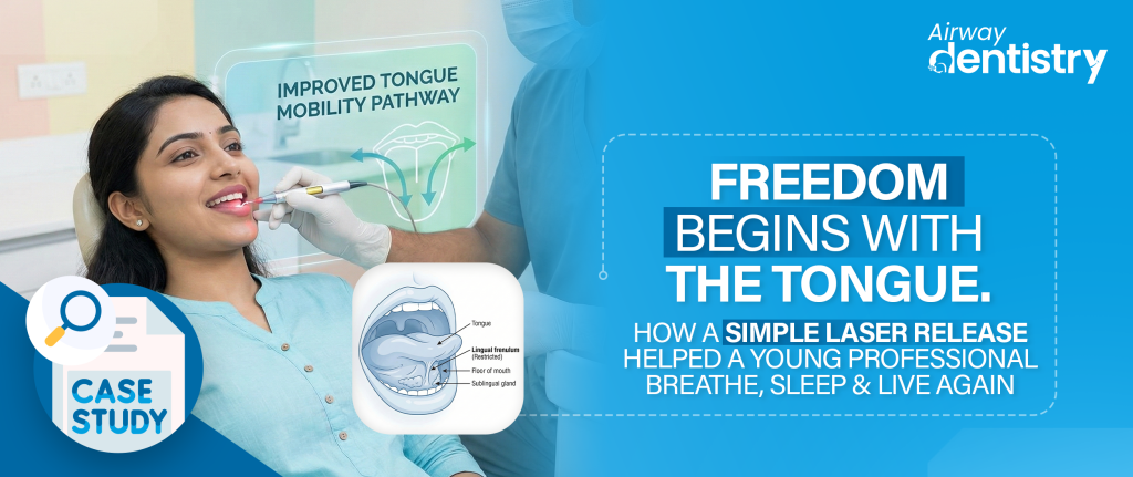 Tongue-tie treatment in Hyderabad