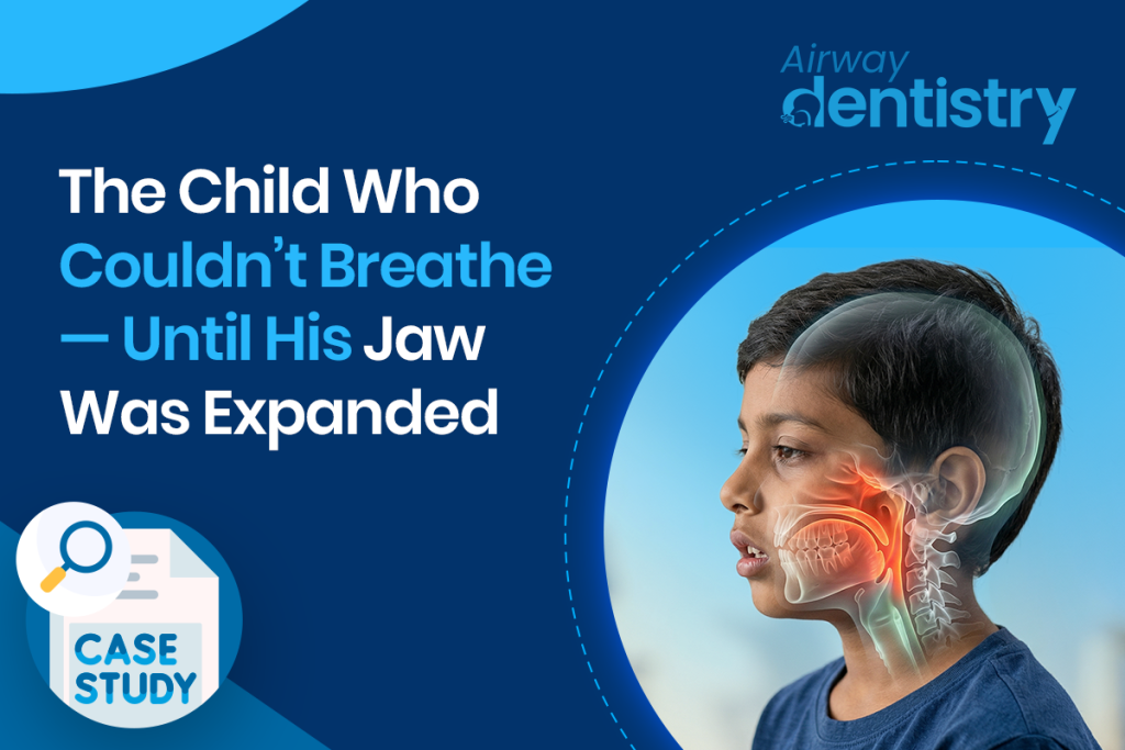 airway dentistry Hyderabad